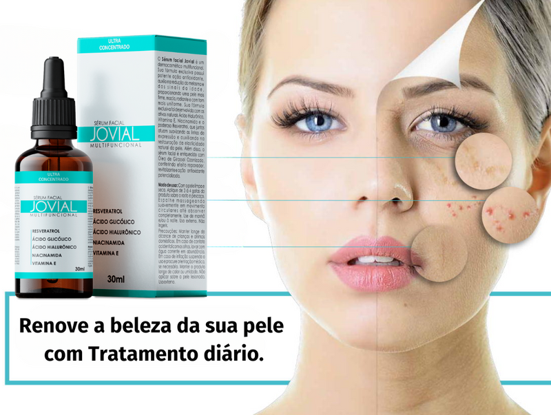 Jovial Serúm Facial anti-idade Manchas e Melasma